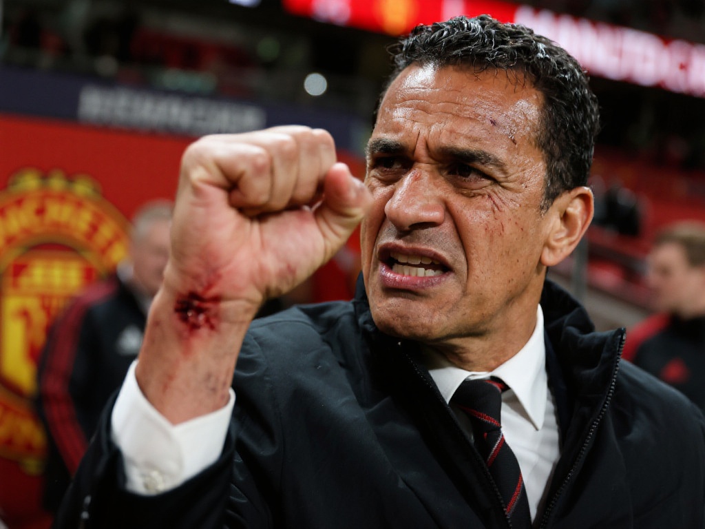 阿莫林拳头现新伤痕，怒批曼联阵容惹争议！